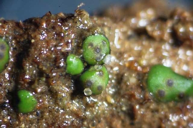 Epatica da determinare